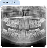 m2 Glossary of Terms