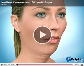 o11 Orthognathic Surgery