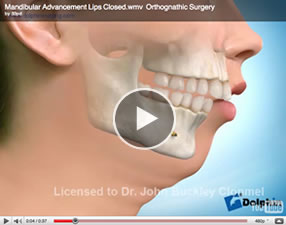 o12 Orthognathic Surgery