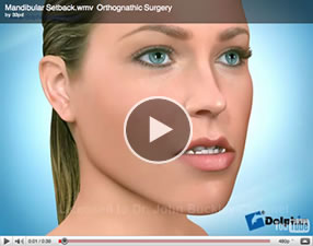 o13 Orthognathic Surgery