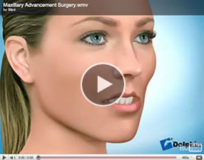 o15 Orthognathic Surgery