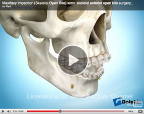 o17 Orthognathic Surgery