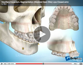 o19 Orthognathic Surgery