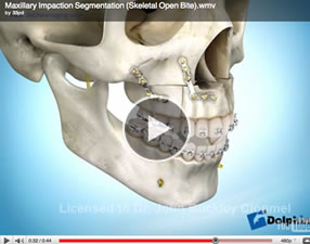 o191 Orthognathic Surgery