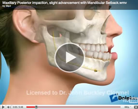 o22 Orthognathic Surgery