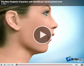 o23 Orthognathic Surgery