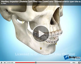 o24 Orthognathic Surgery