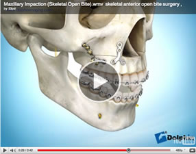 o25 Orthognathic Surgery