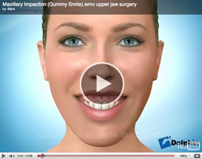 o26 Orthognathic Surgery