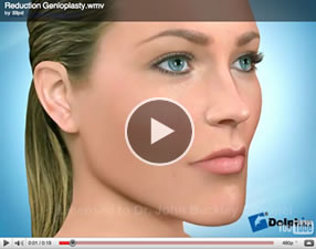 o27 Orthognathic Surgery