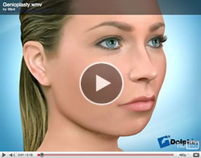 o28 Orthognathic Surgery