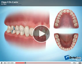 video77 Glossary of Terms