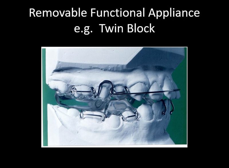 Can Orthodontic Functional Appliances Really Make the Lower Jaw Grow