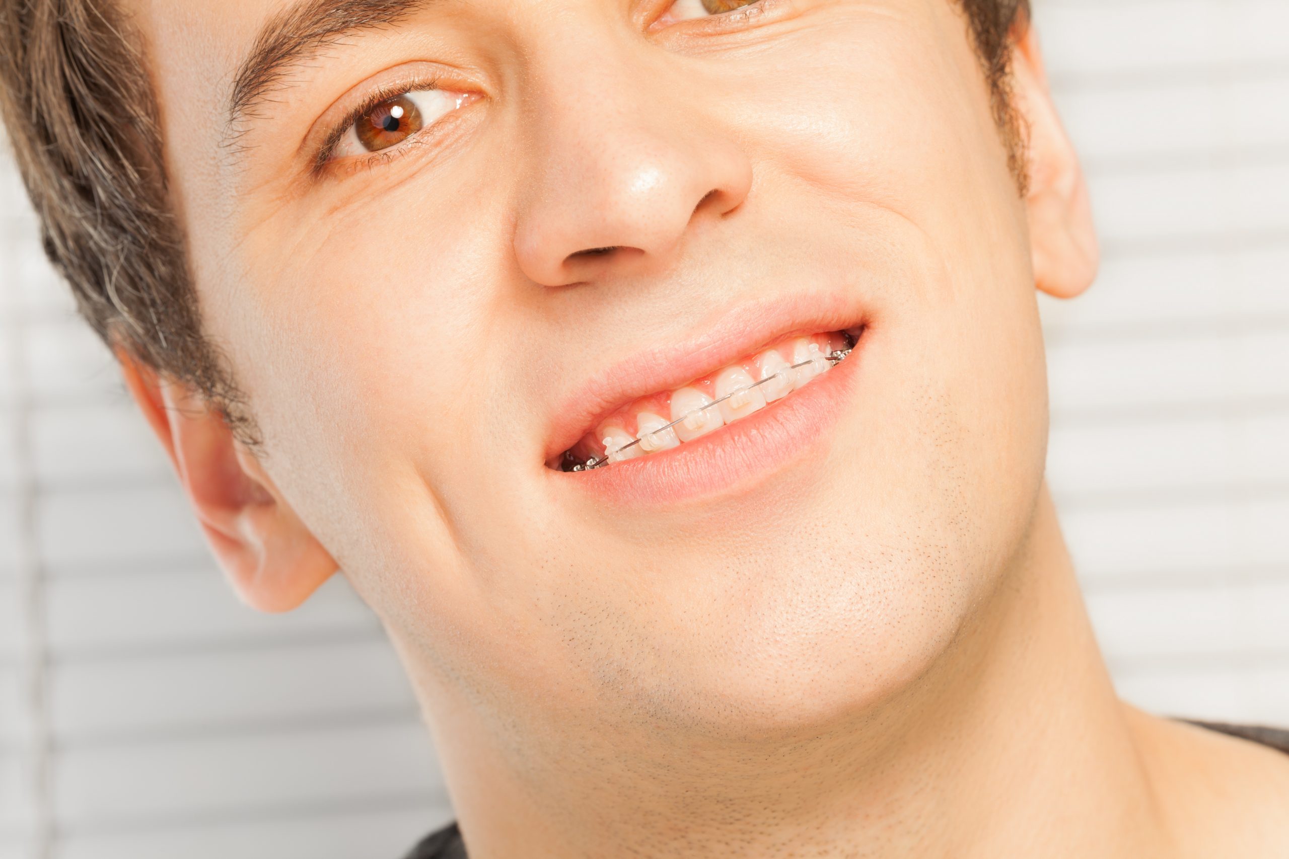 shutterstock_544569865-scaled What is Invisalign and How Does it Make Teeth Move ? Part A.