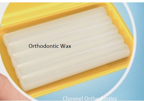 CapturOrthodontic-wax4 What is Orthodontic Wax for?