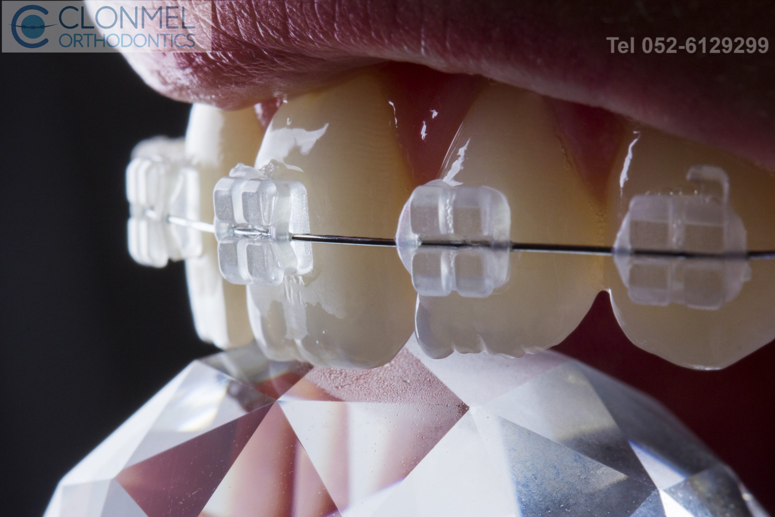 ceramic-1-pw2-scaled Latest News