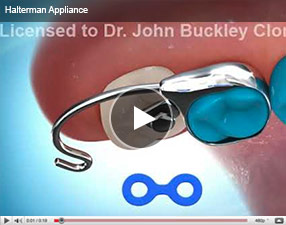 video-halterman-appliance Glossary of Terms