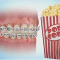 Popcorn and orthodontic treatment.