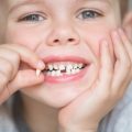 Why do we try to avoid losing baby teeth prematurely?