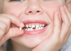 Why do we try to avoid losing baby teeth prematurely?