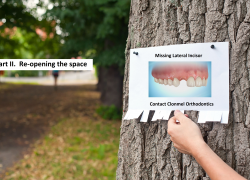 Missing Lateral Incisors  Part 2. “The re-opening the space option.”